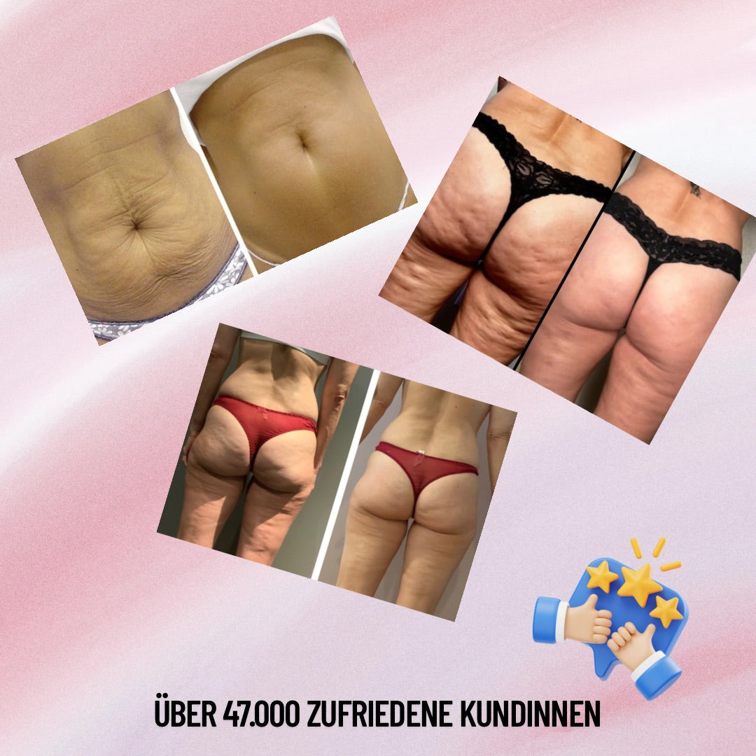 CELLUFREI®